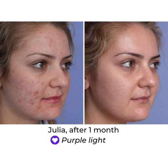 NIB Predire Paris 8 Element Treatment Led Mask - Picture 6 of 15